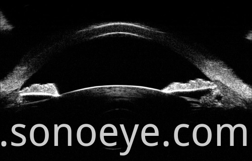 image for Ophthalmic A/B Scanner